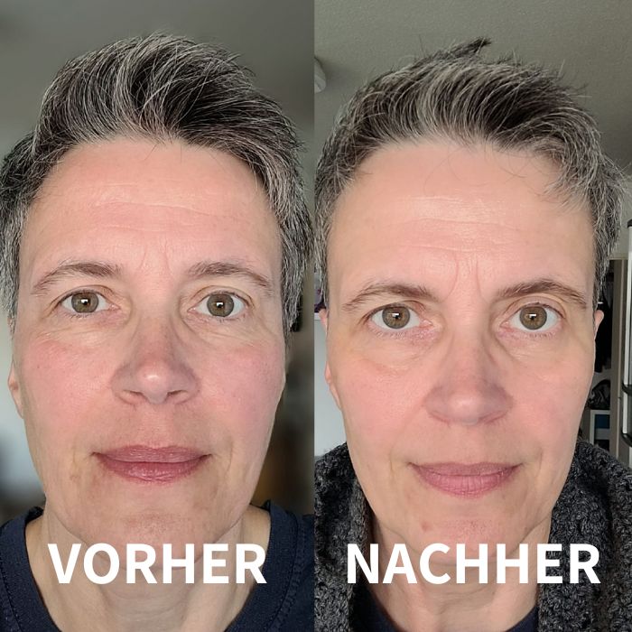 VORHER